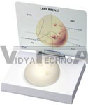 Human Breast Cancer Examination Model - Patient Education Card Included